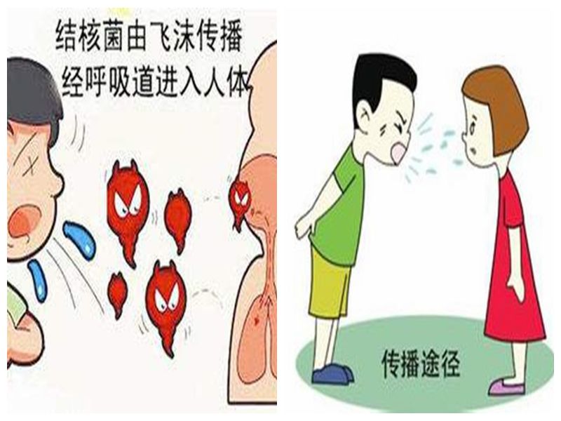肺结核的传播途径 人人都有可能被传染.